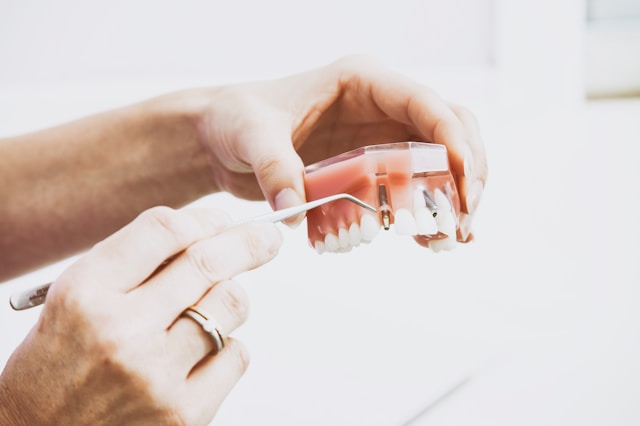 Who is a Good Candidate for Dental Implants? Dental Implants