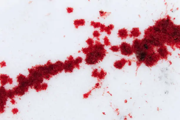 How To Remove Blood Stains From White Sheets