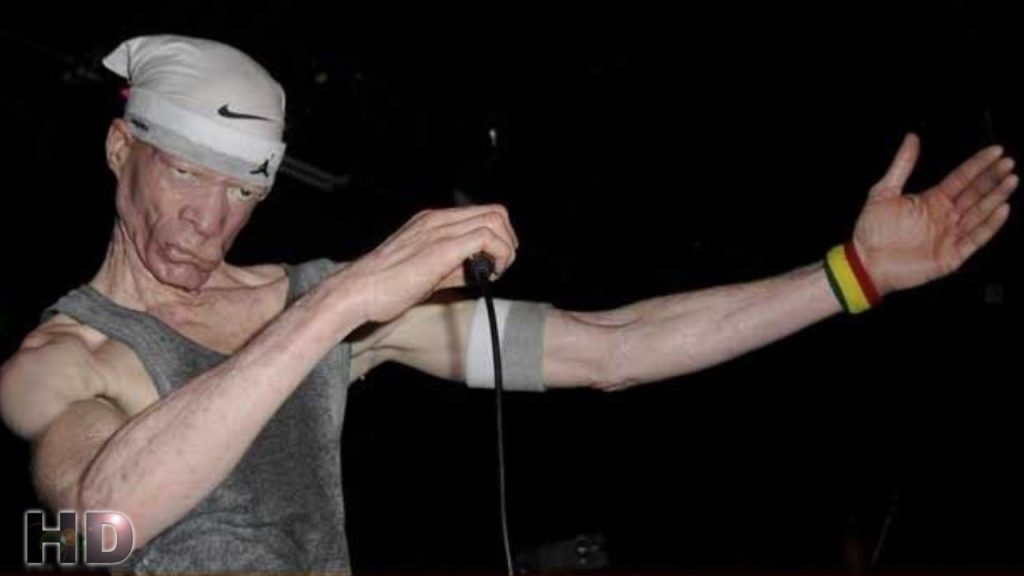Yellowman Net Worth Yellowman Net Worth