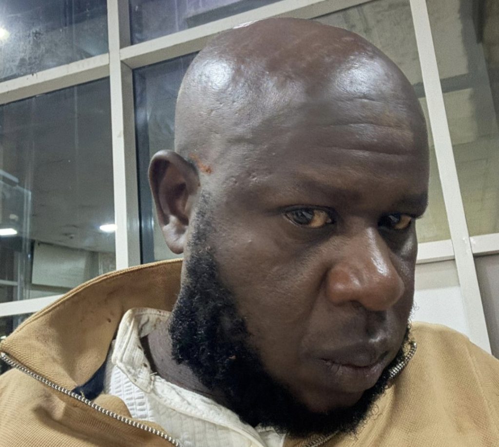 MCA claims he was attacked by goons erecting a billboard in Nairobi