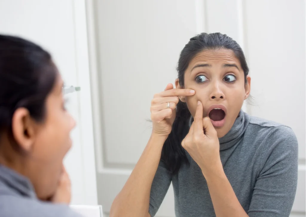 How To Get Rid Of Masturbation Pimples