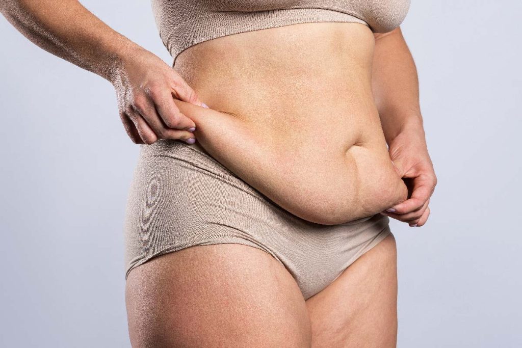 How To Get Rid Of Hanging Belly After C Section