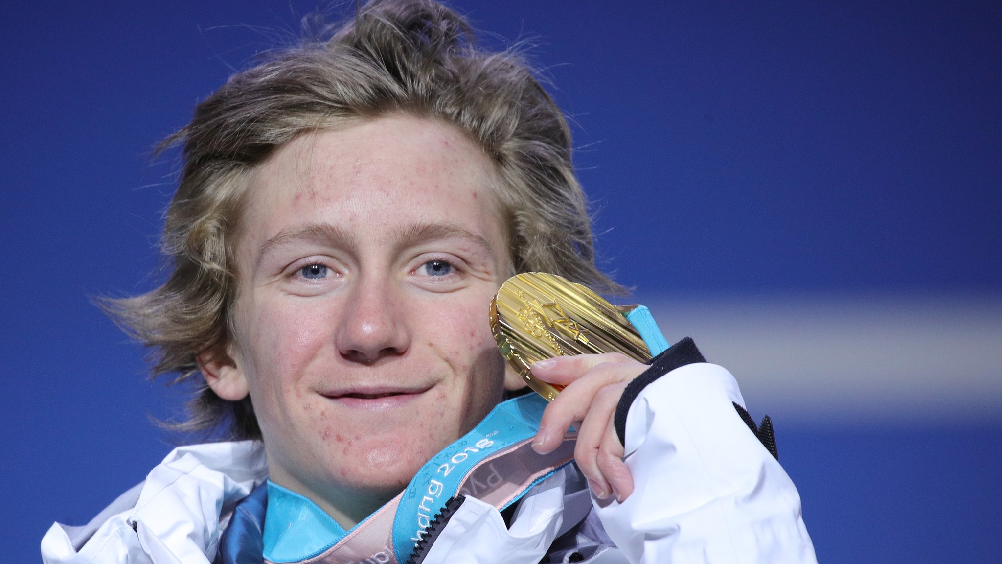 Red Gerard Net Worth