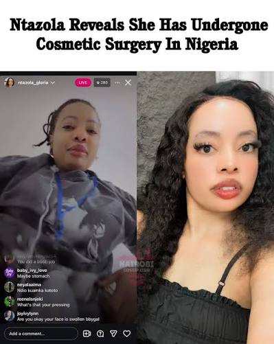 Why President Ruto Should Let SHA Cover BBL Surgeries to Secure the Women’s Vote in 2027 Viral Kanjo lady Gloria Ntazola has revealed that she underwent cosmetic surgery in Nigeria