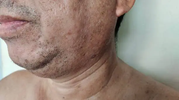 How to Avoid Itching After Shaving How to Avoid Itching After Shaving